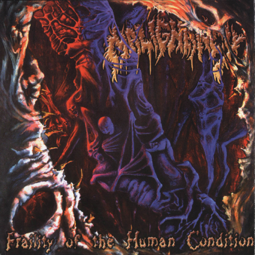 Malignancy & Intervalle Bizzare - 2002 - Split/cover.jpg